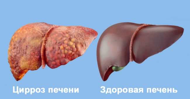 Пути передачи гепатита с - фото № 1 Пути передачи гепатита с - фото № 1