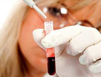 Можно ли обнаружить вирус гепатита С при проверке на ЗППП - фото № 1 Можно ли обнаружить вирус гепатита С при проверке на ЗППП - фото № 1